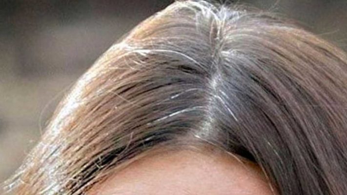 Premiers cheveux blancs : que faire pour lutter contre les cheveux blancs